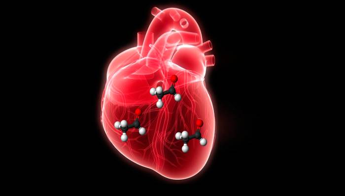 Алкогольная кардиомиопатия