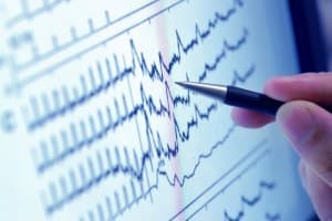 Алкогольная кардиомиопатия