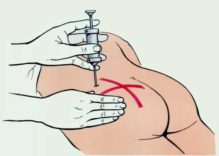 Раскодирование от алкоголя