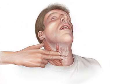 Признаки отравления метилом