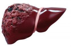 Можно ли совмещать Аспирин с алкоголем