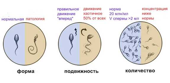 Алкоголь перед спермограммой