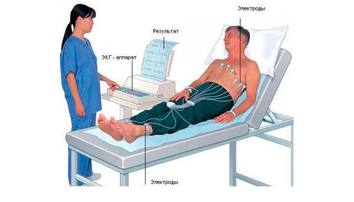 Алкогольная кардиомиопатия