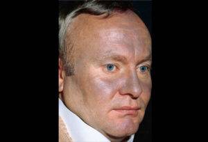 Запойный алкоголизм