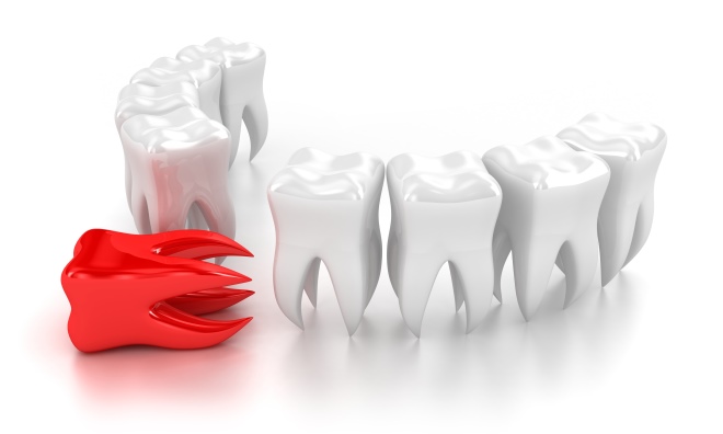 Можно ли алкоголь после удаления зуба